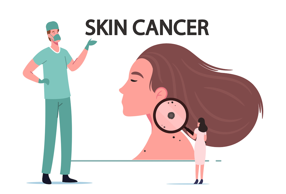 How to Find the Best Skin Cancer Surgeon in Hagerstown, Maryland for Reconstruction